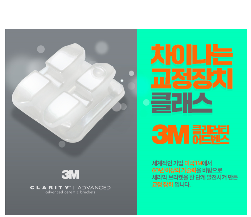 세라믹교정 3M  치아교정 모델 신청 ~ 관련 이미지 3