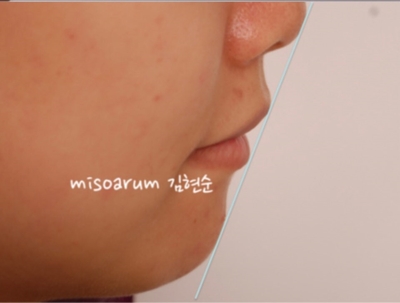 강남치아교정추천 관련 이미지 42