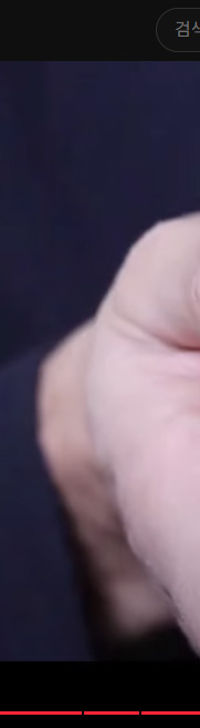 강남치아교정, 악궁확장하면 얼굴크기 커질까? 관련 이미지 8