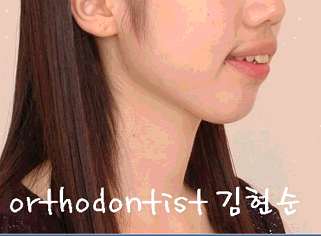 강남 돌출 관련 이미지 4