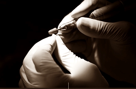 무삭제라미네이트 , 세라네이트가 궁금하다면? 관련 이미지 11