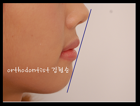 강남교정치과 관련 이미지 38