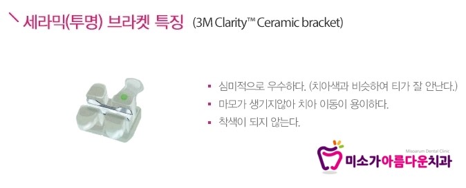 학동역치아교정치과 미소가아름다운치과의 교정창지 관련 이미지 3