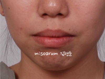 강남치아교정추천 관련 이미지 34