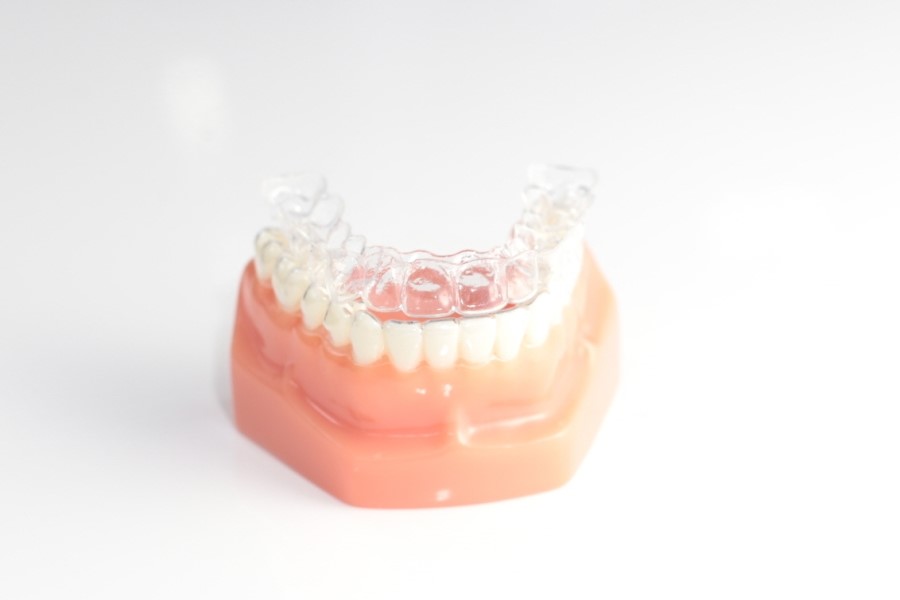 세라믹교정 세라믹치과 - 아나운서 교정이 뭘까요 ? 관련 이미지 2