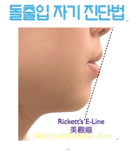 학동역치과 치아교정은 여기서 !! 관련 이미지 15