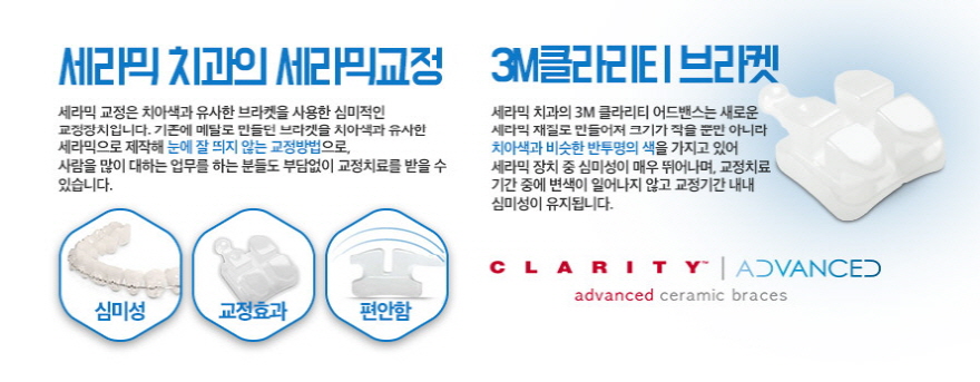 세라믹교정 비용 부작용없이 관련 이미지 3