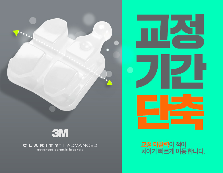 미국3M치아교정 클래러티 어드밴스 세라믹치과 관련 이미지 4