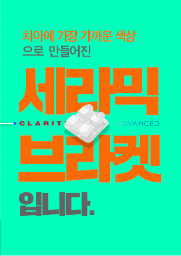 세라믹치과 3M 클래러티 어드밴스 치아교정 전속모델 콘테스트 관련 이미지 6