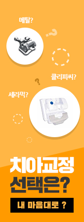 세라믹치과 이벤트 관련 이미지 2
