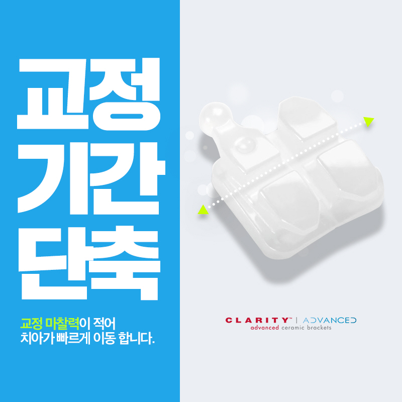 학동역 치아교정 3M 클래러티 어드밴스 관련 이미지 5