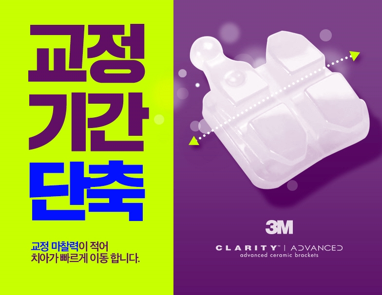 세라믹치과 돌출입교정은 미국3M 치아교정으로 관련 이미지 6