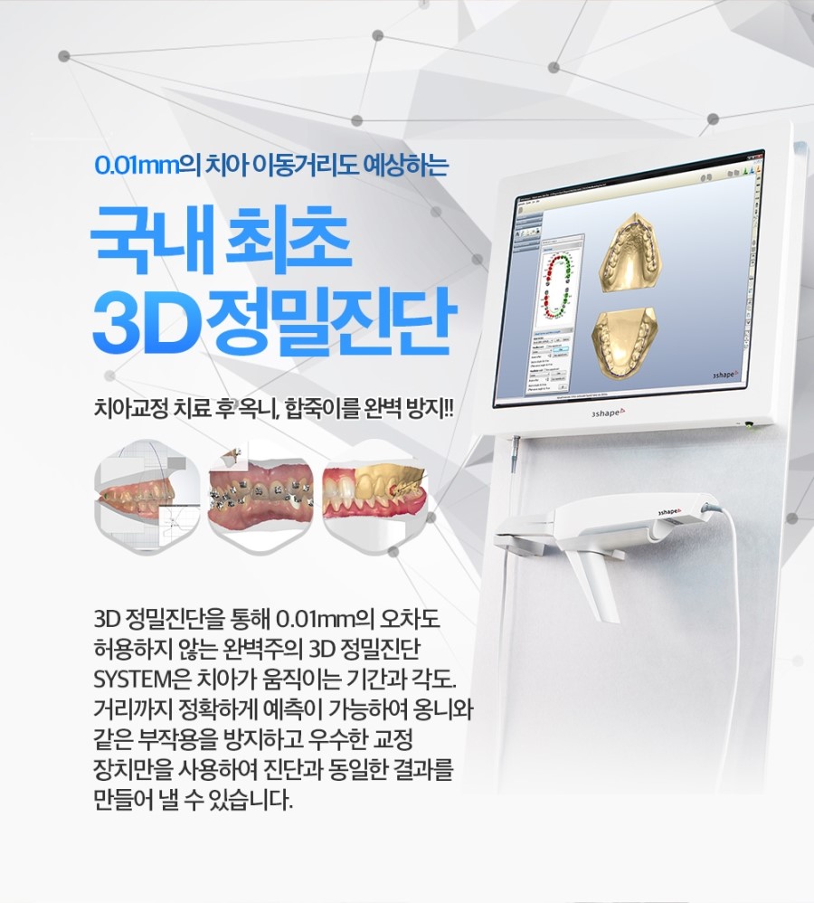 세라믹교정 이벤트 관련 이미지 6