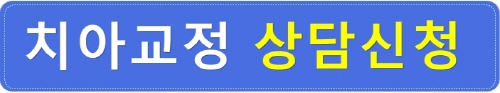 치아교정전후 영상 : 돌출입과 중심선비대칭 인상변화 관련 이미지 5