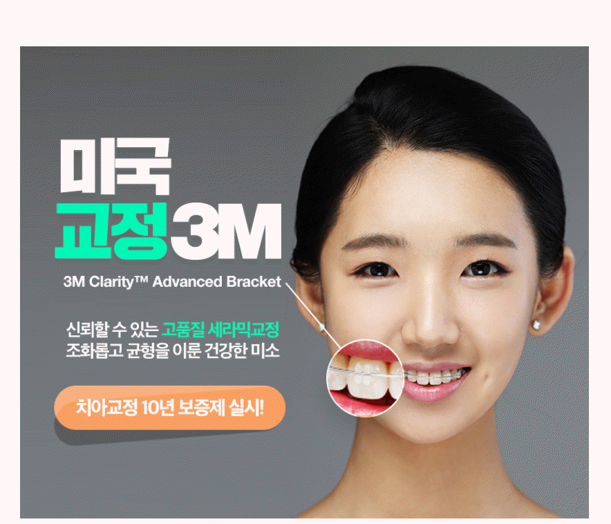 세라믹치과 3M 클래러티 어드밴스 치아교정 전속모델 콘테스트 관련 이미지 2