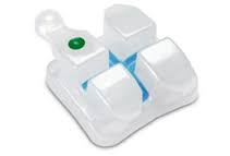 세라믹교정 장점 관련 이미지 2