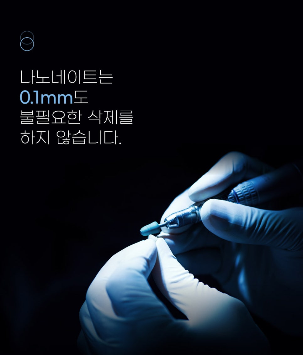 치아교정과 라미네이트는 선택이 아닌 상호 보완관계! 관련 이미지 4