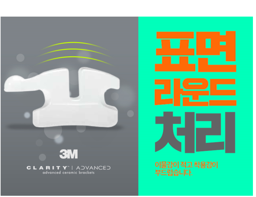 세라믹교정 3M  치아교정 모델 신청 ~ 관련 이미지 7