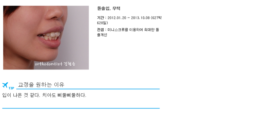 돌출입 발치교정, 미니스크류를 통한 6가지 변화 관련 이미지 4