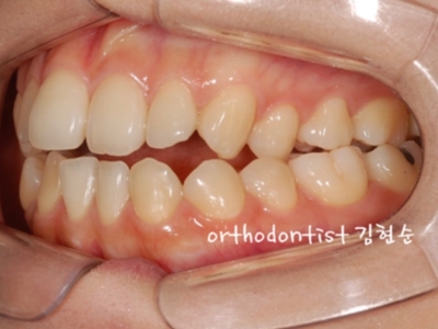 강남교정치과 관련 이미지 34