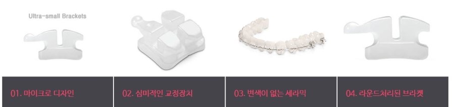 세라믹교정 세라믹치과 - 일상중에도 편안하게 교정한다 관련 이미지 5