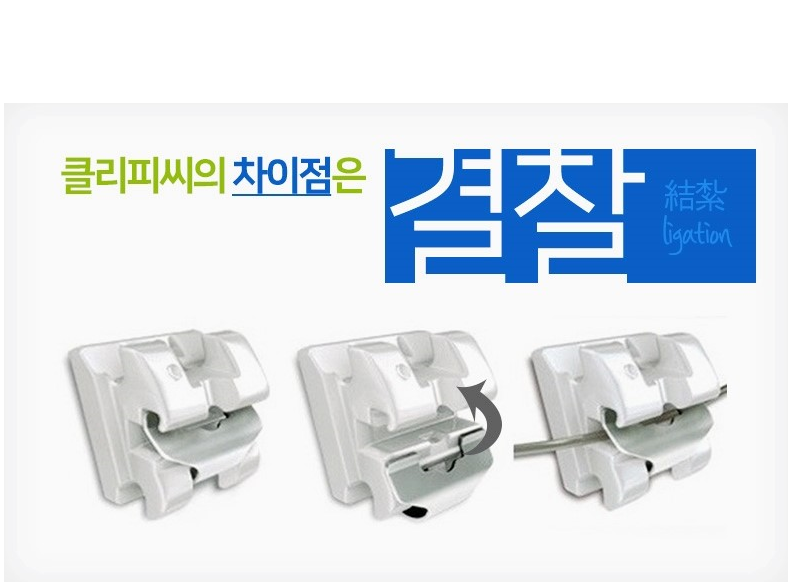 세라믹치과 클리피씨 교정 장점 관련 이미지 3