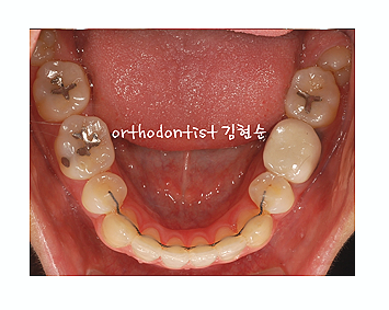 강남교정치과 관련 이미지 18