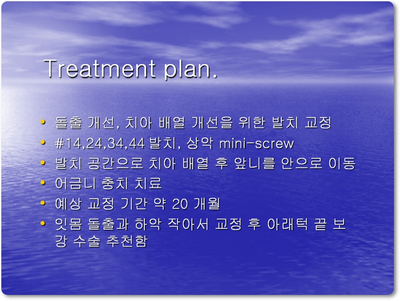 돌출입 잇몸노출 치아교정 전후 인상변화 사례 관련 이미지 10