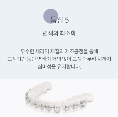세라믹치과에서 세라믹교정이 인기있는 이유! 관련 이미지 10