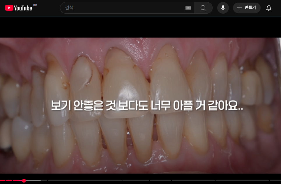 치아교정 중 잇몸 내려앉는 현상? 잇몸퇴축 발생 원인과 예방법 관련 이미지 3