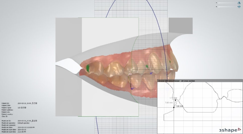 학동역치과 치아교정은 여기서 !! 관련 이미지 13