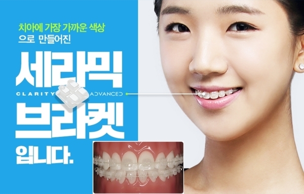 학동역 교정치과, 세라믹치과의 세라믹교정 관련 이미지 1