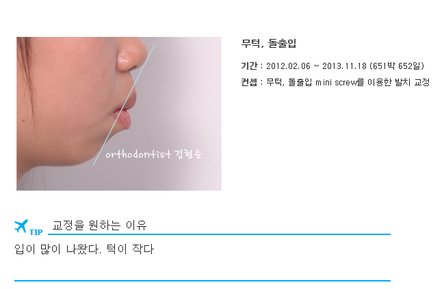 미니스크류를 이용한 발치 돌출입 교정, 무턱 개선 관련 이미지 4