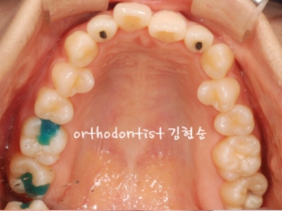 강남교정치과 관련 이미지 3