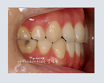 강남교정치과 관련 이미지 21
