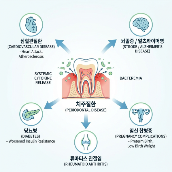 청담 치과, 양치할 피가 섞여 나온다면 - 치주염 관련 이미지 4