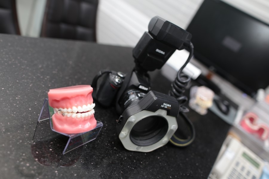 세라믹교정 미국3M 클라리티 관련 이미지 3