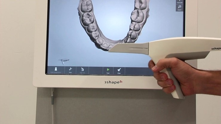 김현순원장의 3D miso 교정 (3D 미소교정) 관련 이미지 3