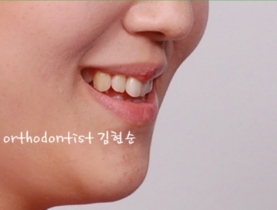 강남교정치과 관련 이미지 38