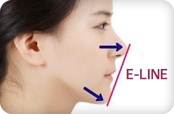 강남치아교정 브라켓비교분석 관련 이미지 10