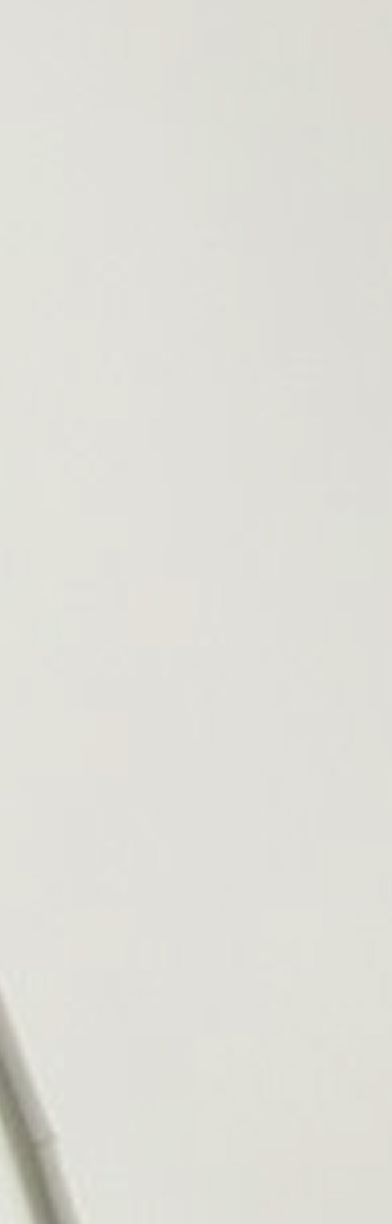 수술없이 얼굴 턱선 정리하는 치아교정, 무턱교정 관련 이미지 17