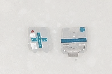 학동역치과 하면 세라믹교정 ~ 관련 이미지 23