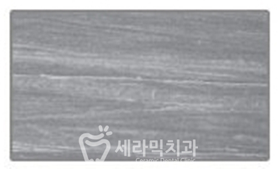 치아교정 유지장치와 틀니, 제대로 관리하는 법! 관련 이미지 7