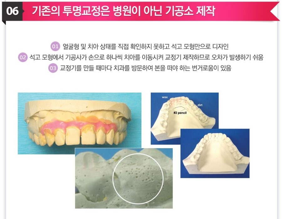 [ 학동역 치과 ] 투명교정의 새이름 3D miso 교정 관련 이미지 8