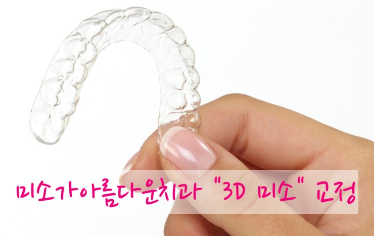 김현순원장의 3D miso 교정 (3D 미소교정) 관련 이미지 7