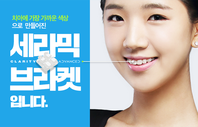 세라믹치과 세라믹교정은 미국3M에서 만든 브라켓 관련 이미지 6