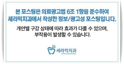 돌출입 치아교정전후 세련된 옆라인을 되찾다! 관련 이미지 5