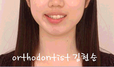 강남 돌출 관련 이미지 3