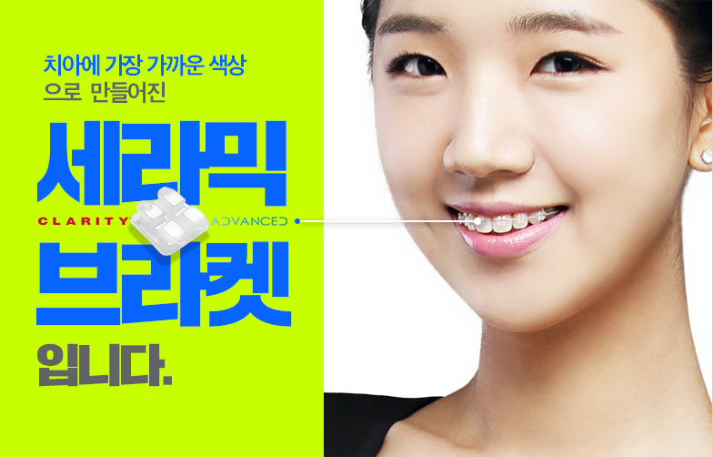 학동역치과 미국3M교정 추천 ~~ 관련 이미지 6