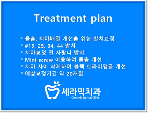 돌출입교정으로 갸름한 턱라인까지 되찾다! 돌출입 치아교정전후 관련 이미지 15